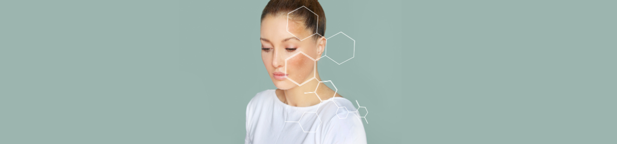 A woman with a serene expression is shown against a muted green background, with translucent white hexagonal molecular structures superimposed on her face and neck. The image has been used to reflect the theme of this artilce, which is Rejection of Shaperon's patent for skin disorder management