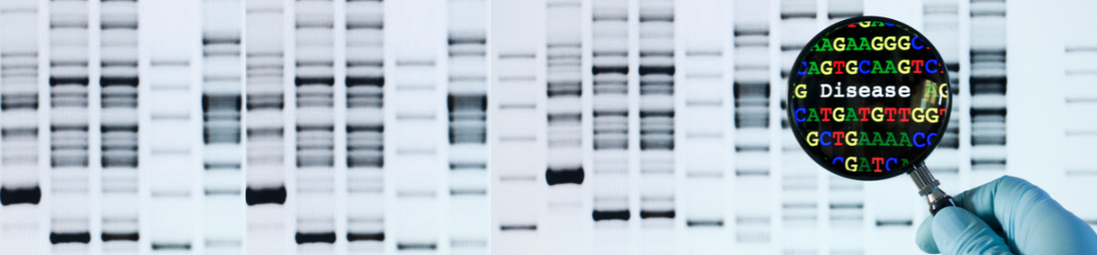 DNA gel bands with a magnifying glass highlighting DNA bases and the word “Disease